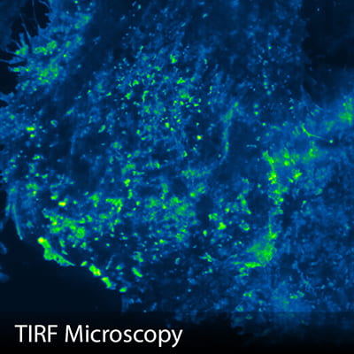 TIRF Microscopy
