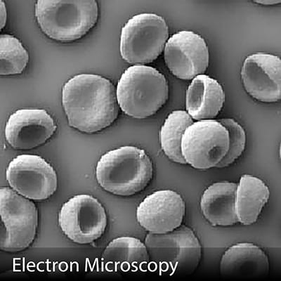 Electron Microscopy